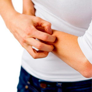 Having Trouble with Eczema? Some Causes and Cures.