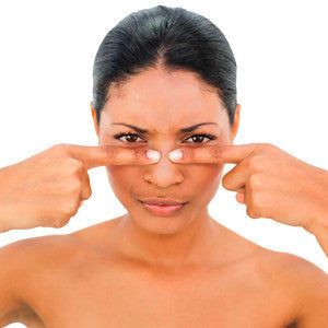 Tips for Preventing and Getting Rid of Blackheads